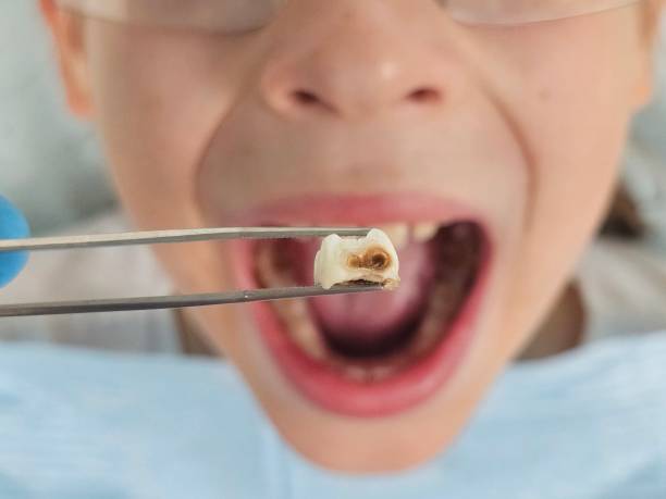 Best Tooth Infection Emergency Dentist  in Cienega Springs, AZ
